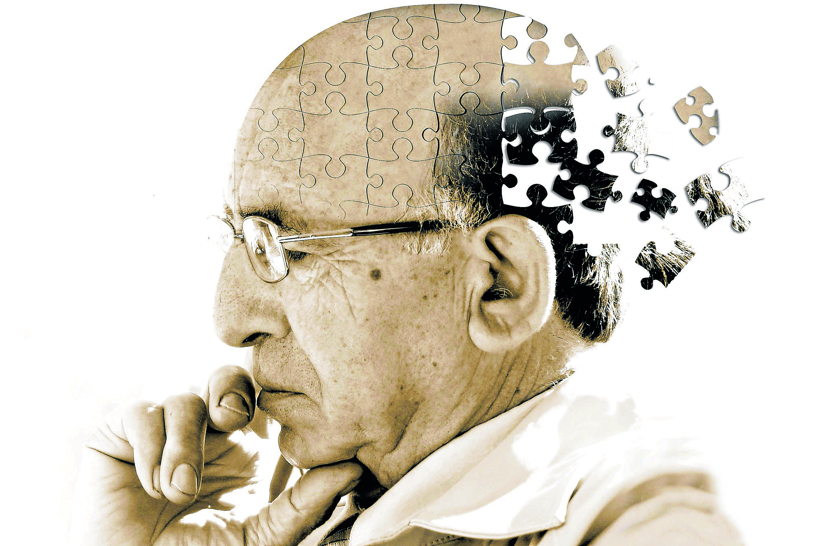 Alzheimer, a doena do sculo